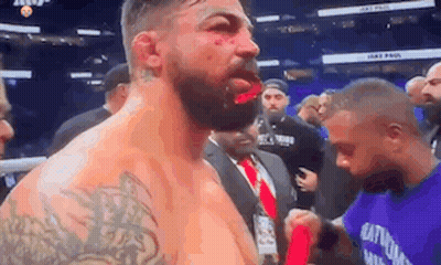 Bearded Man With Bloody Face In Boxing Ring GIF