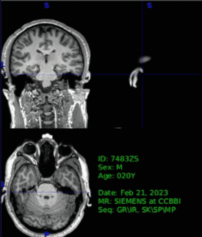 Black And White Brain February 21St 2023 GIF