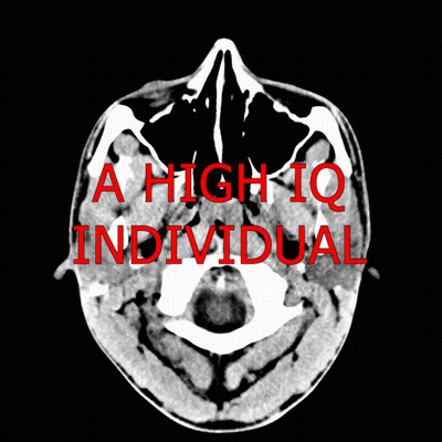 Black And White Brain With A High IQ Individual GIF