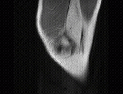 Black And White Elbow And Knee GIF