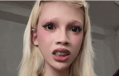 Blonde Girl With Braces Looking At Camera GIF