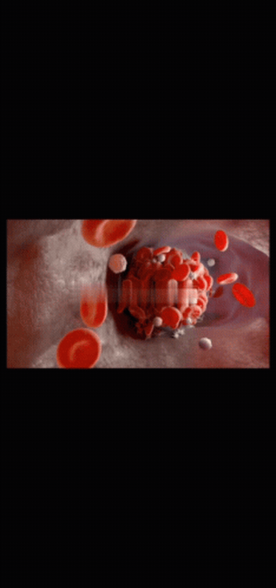 Blood Cells Moving Through Blood Vessel GIF