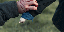 Blood Dripping On His Hand GIF