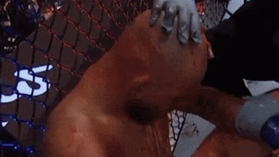 Bloodied Boxer Wiped With Towel In Ring GIF