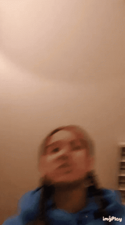 Blurry Woman's Face With Nose Bandage GIF