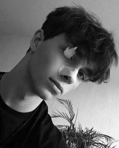 Boy With Bandage On Nose Looking At Camera GIF