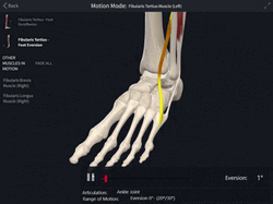Broken Ankles Xray Results GIF