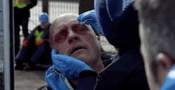 Chemical Burn Chicago Fire GIF