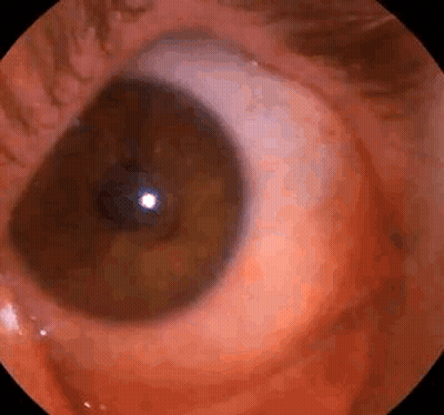 Close Up Eye With Blood Coming Out GIF