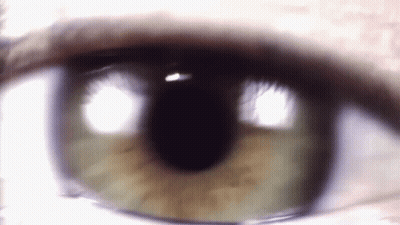 Close Up Eye With Few White Spots GIF
