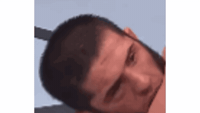 Close Up Man With Beard And Red Eye GIF
