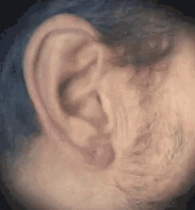 Close Up Of Ear Against Blue Background GIF