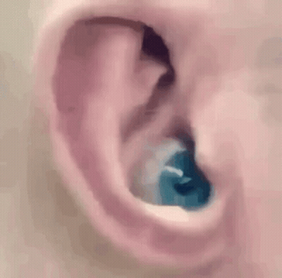 Close Up Of Ear With Blue Ear Plug GIF