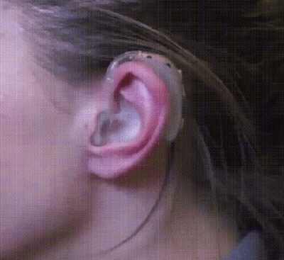 Close Up Of Ear With Hearing Aid GIF