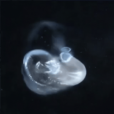 Close Up Of Jellyfish On Black Background GIF