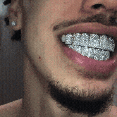 Close Up Of Man's Mouth With Diamond Teeth GIF