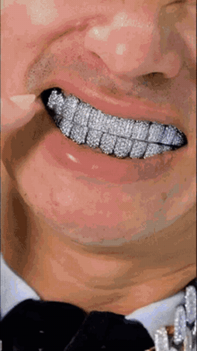 Close Up Of Man's Teeth With Diamonds GIF