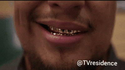 Close Up Of Man's Teeth With @Tvresidence GIF