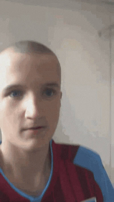 Close Up Of Man With Shaved Head GIF
