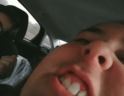 Close Up Of Mouth And Teeth GIF