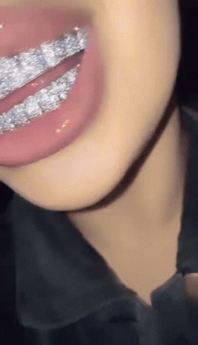 Close Up Of Mouth With Braces GIF