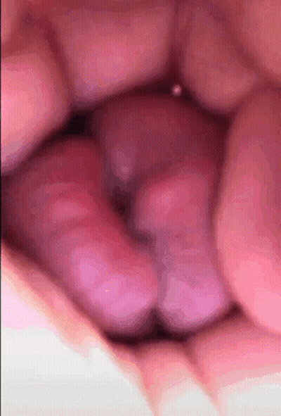 Close Up Of Mouth With Purple Object GIF