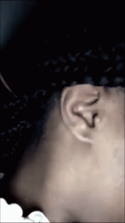 Close Up Of Person's Neck And Ear GIF