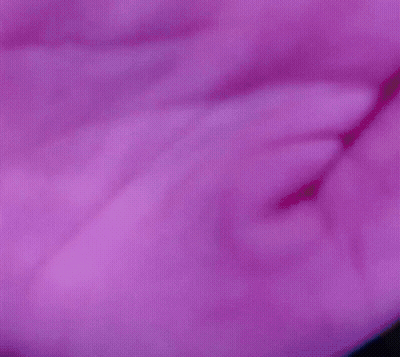Close Up Of Purple Shirt GIF
