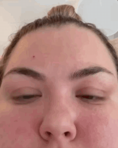 Close Up Of Woman's Forehead With Eyes Closed GIF
