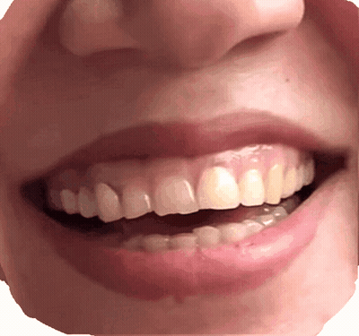 Close Up Of Woman Showing Teeth GIF