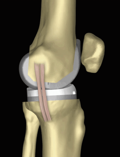Computer Generated Knee Joint GIF