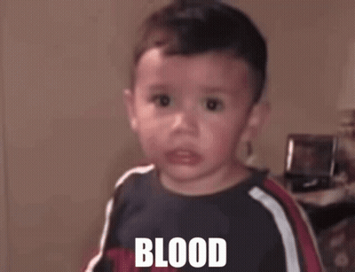 Crying Little Boy Blood Shirt GIF