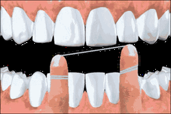 Dental Floss Animation GIF