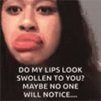 Do My Lips Look Swollen GIF