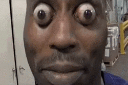 Eyes Popping Out Man Playing His Eyes GIF