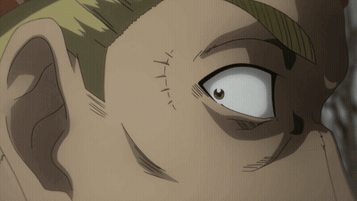 Face With Stitch In Eye GIF