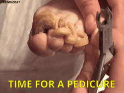 Feet In Need Of Pedicure GIF
