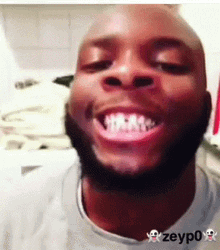 Funny Man Playing With Denture Missing Teeth