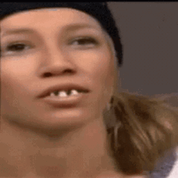 Funny Woman Laughing With Missing Teeth Dentures GIF 