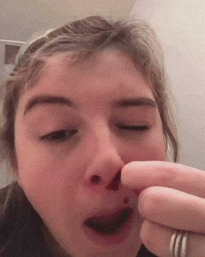 Girl Holding Nose With Blood GIF