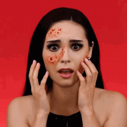 Girl Shocks When Saw Scab On Face GIF