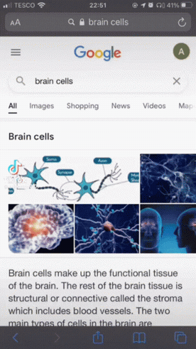 Google Search For Brain Cells On Phone Screen GIF