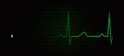 Green Heartbeat Monitor With Heartbeat Line GIF
