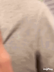 Guy With Hickey Marks GIF
