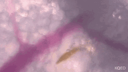 How To Bite Mosquito   GIF