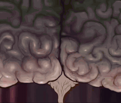 Human Brain With Tree Trunk GIF