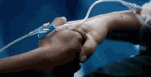 Immediate Blood Transfusion GIF