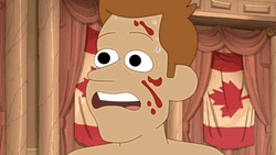 Inside Job Bloody Face Brett Hand GIF