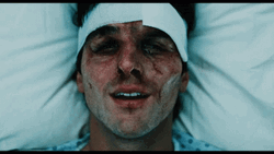 Jacob Elordi Smiling Beat Up Face Close Up GIF