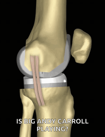 Knee Saying Is Big Andy Carroll Playing GIF